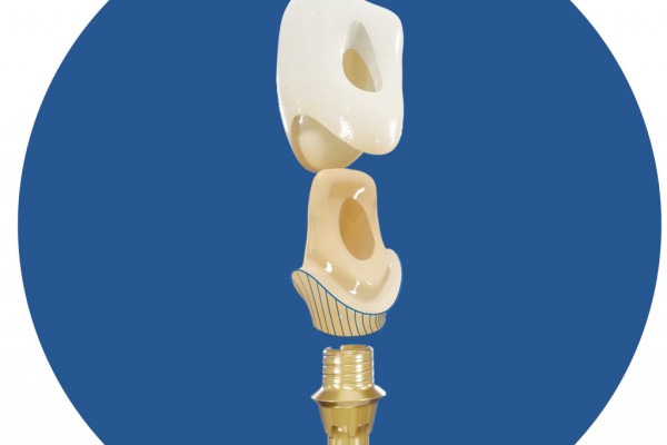 Why Our Dental Hybrid Bases With One Collar Height Make Perfect Sense Wpv 1024x683 Center Center